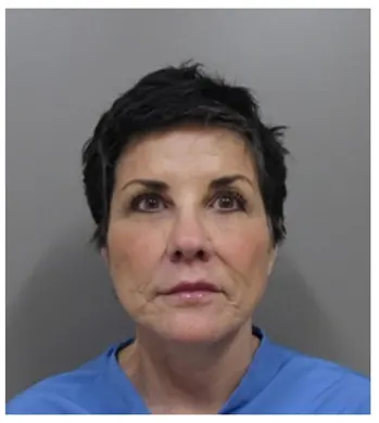 Portland Facelift and Necklift with fat transfer and Juvederm John Lee 4