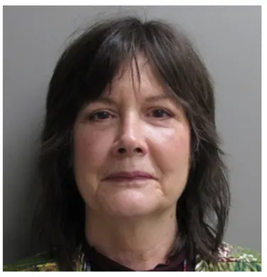 Dr-Lee-Portland-Plastic-Surgery-in-Beaverton-OR-case-15-blepharoplasty-front-thumb