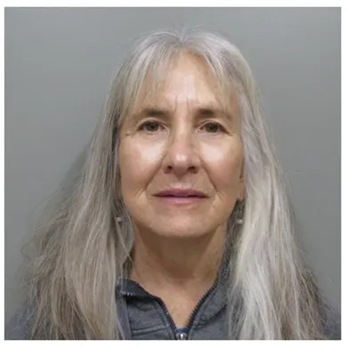 John S Lee MD Plastic Surgery Facelift Case 24 after front thumb