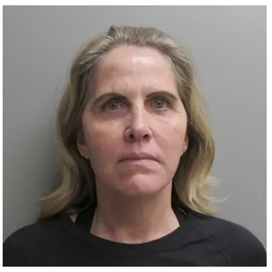 John S Lee MD Plastic Surgery Facelift Case Study 26 - Front Thumb