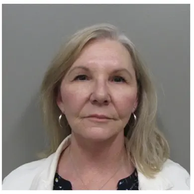John S Lee MD Plastic Surgery Facelift Case Study 27 - Front thumb