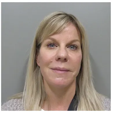 John S Lee MD Plastic Surgery Facelift Case 29 frontThumb