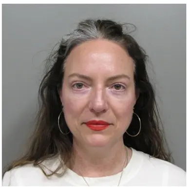 John S Lee MD Plastic Surgery Blepharoplasty Case 25 - front thumb