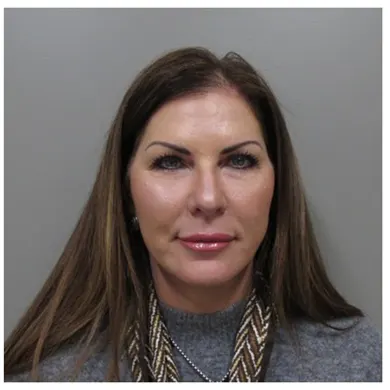 John S Lee MD Plastic Surgery facelift case study 39 front-thumb